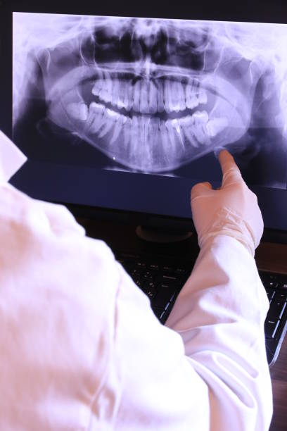 Best Chipped Tooth Repair Near Me  in Powell, OH