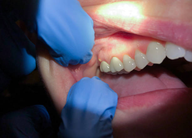 Best Emergency Gum Pain Relief  in Powell, OH