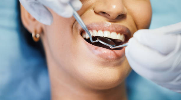 Best Teeth Whitening  in Powell, OH